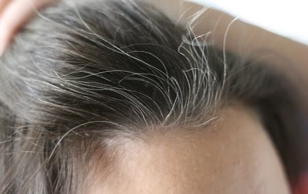 دلایل سفید شدن مو | موی سفید | علت سفید شدن موی سر | موی جو گندمی